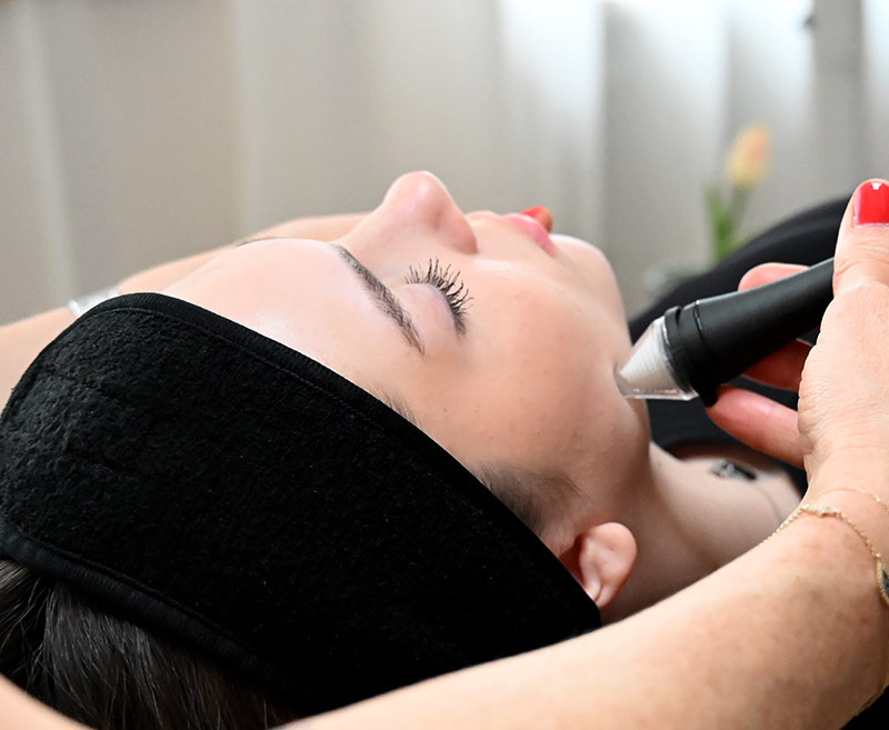 Microdermabrasion Behandlung an der Gesichtshaut einer Frau mit schwarzem Stirnband in heller Praxisumgebung​​​​​​​​​​​​​​​​​​​​​​​​​​​​​​​​​​​​​