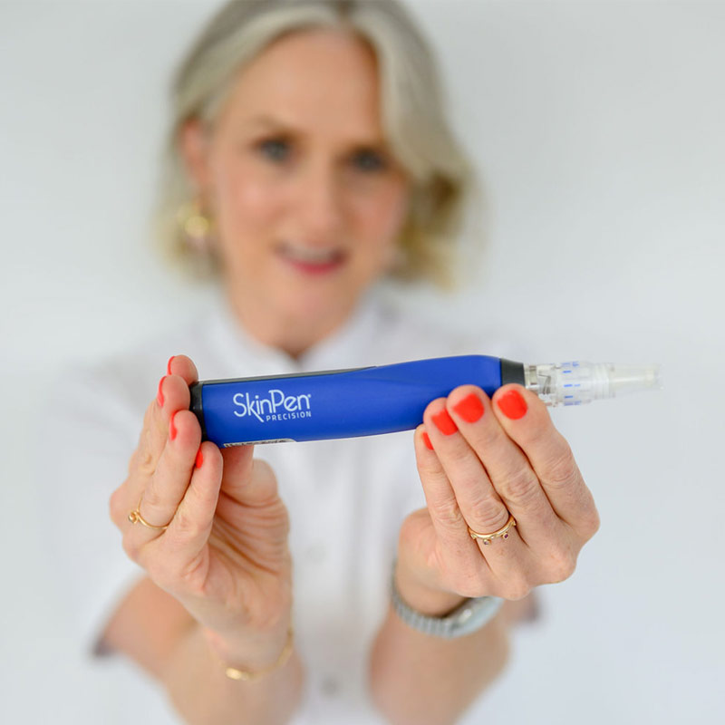 Frau mit roten Fingernägeln zeigt SkinPen Microneedling Gerät vor weißem Hintergrund in Nahaufnahme.​​​​​​​​​​​​​​​​​​​​​​​​​​​​​​​​​​​​​​​​​​​​​